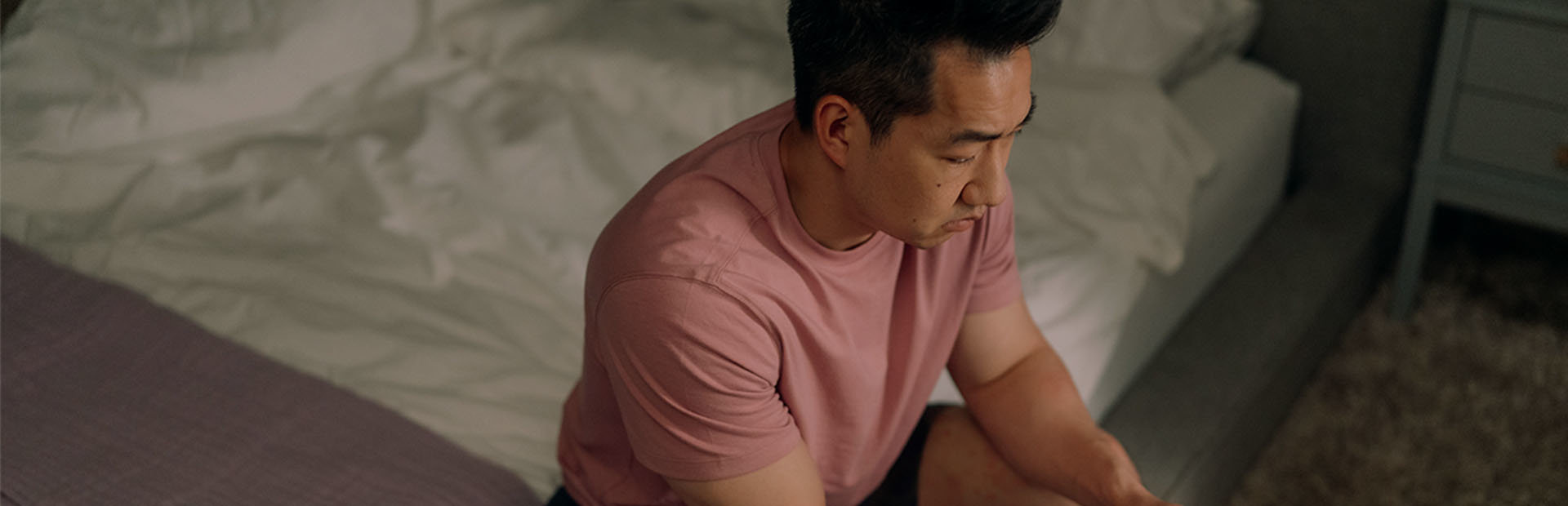 Man in his 30s with hives on bed, looking down