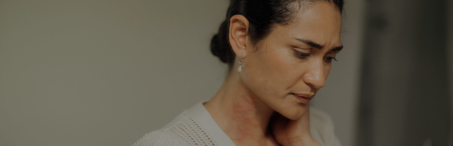 Middle-aged woman with hives on her neck looking down with a sad expression