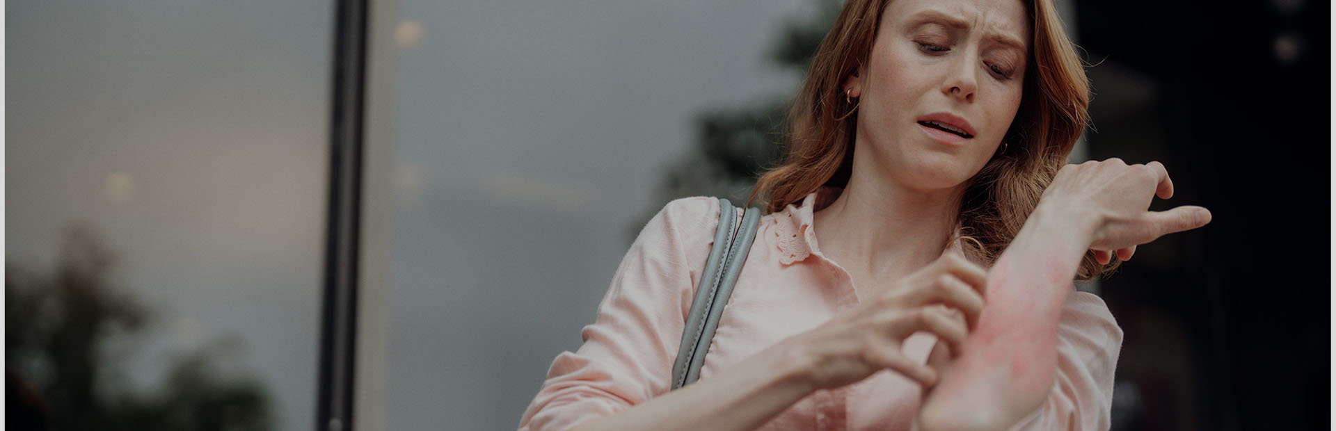 Middle-aged woman scratching her chronic hives in public