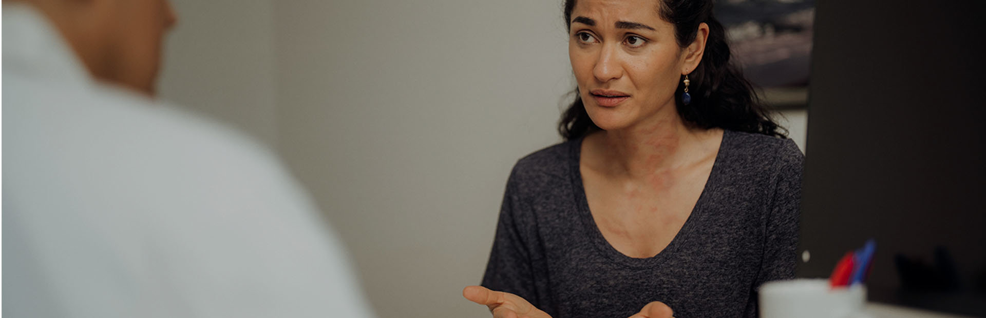 Middle-aged woman with chronic hives talking to her doctor