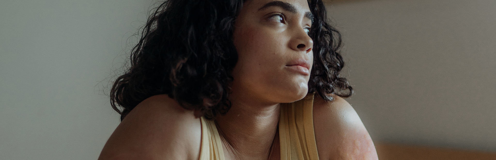 Young woman with hives looking off in the distance
