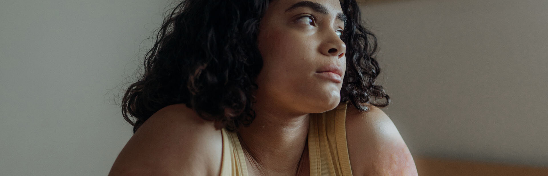 Young woman with hives looking off in the distance