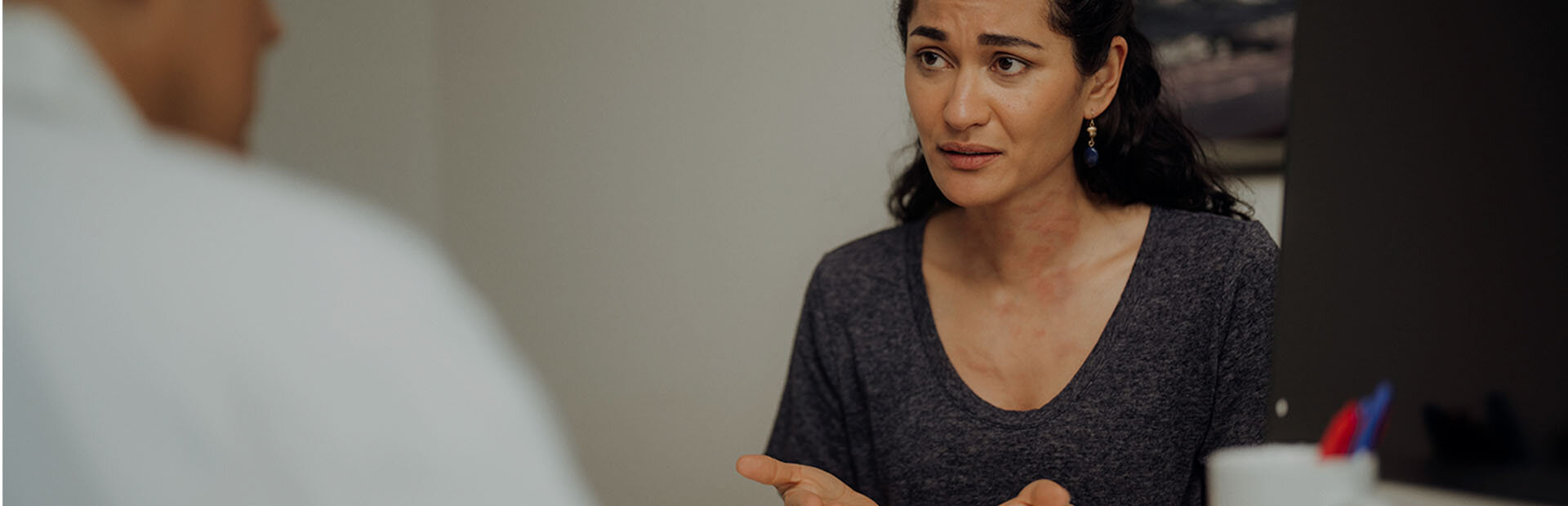 Middle-aged woman with chronic hives talking to her doctor