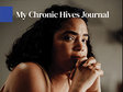 My Chronic Hives Journal PDF