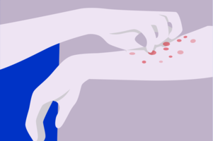 Illustration of person scratching hives